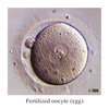 Fertilized-oocyte.jpg