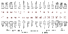 Tooth Numbering System.gif Tooth Numbering System.gif