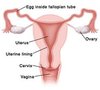 uterus 2.jpg uterus 2.jpg