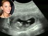 beyonce-sonogram-636.jpg