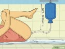 v4-460px-Perform-an-Enema-at-Home-Step-9-Version-4.jpg