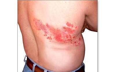 ukanda-wa-jeshi-400x250-jpg.131641