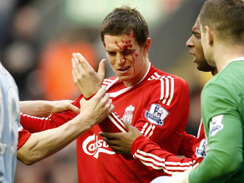 Daniel-Agger-Liverpool-Premier-League_2387364.jpg