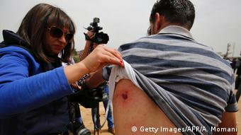 Palästina Demo verletzt Journalisten Schußwunden (Getty Images/AFP/A. Momani)