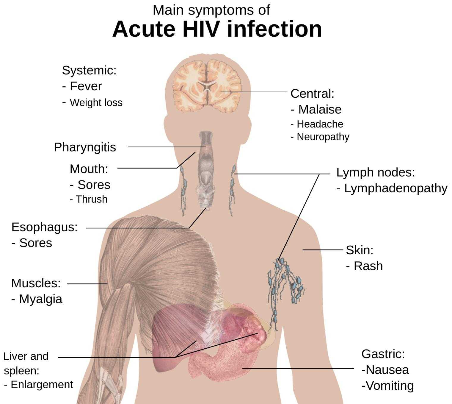 symptoms_of_acute_hiv_infection-svg-jpg.278579