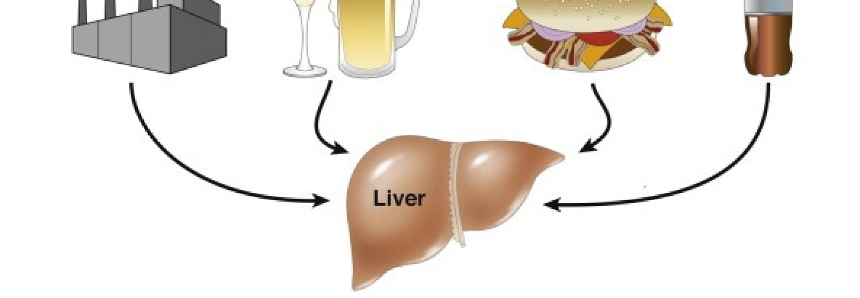 NAFLD_diagram-1764x700