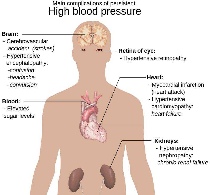 high-blood-pressure-jpg.289027
