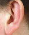 ear_100x120.jpg