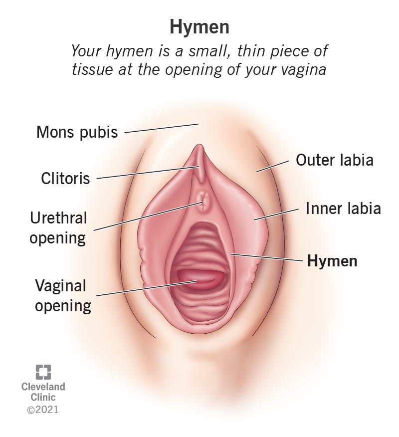 22718-hymen