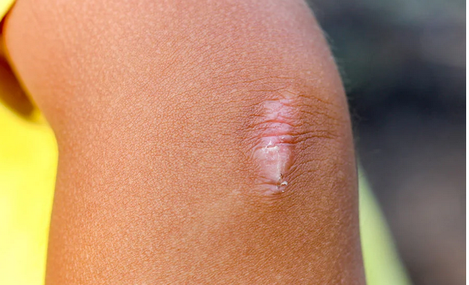 1719125068886-png.3023627