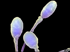 _45046948_sperm_cred226.jpg