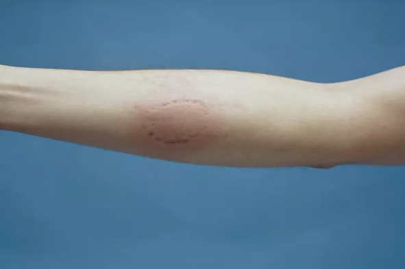 1714516805837-png.2977876